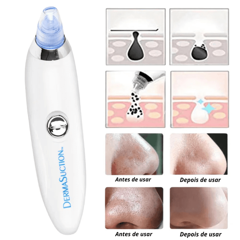 GlowSuction Touch